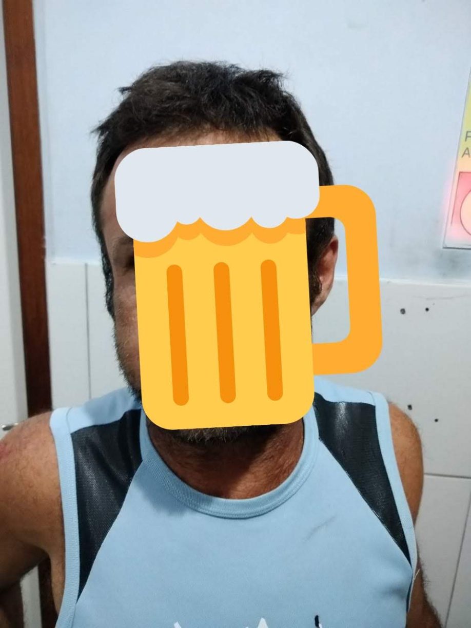 Deu Pinote e acabou de cara no asfalto