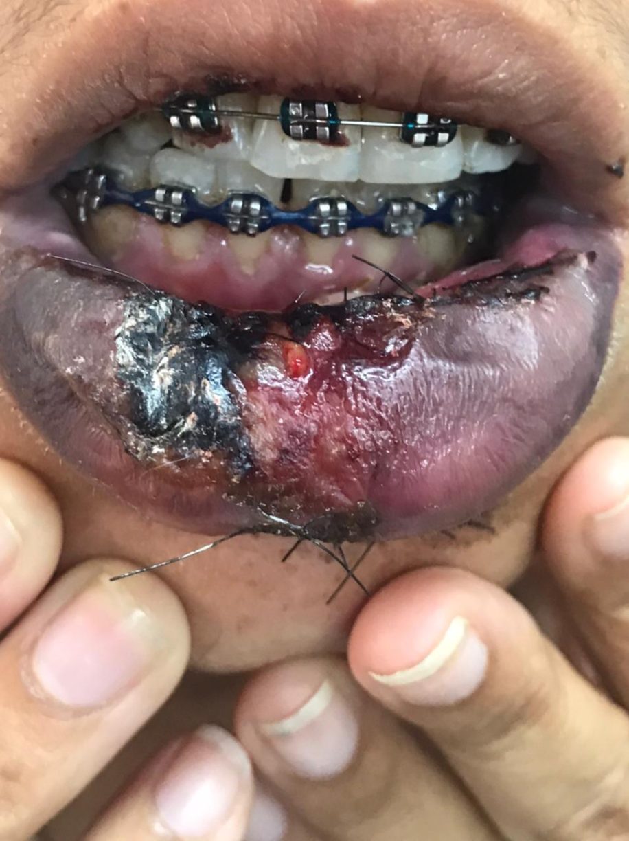 Covarde! Policia Prende Cramunhão que “quebrou a ex mulher no pau” na praça publica em Ipiaú.