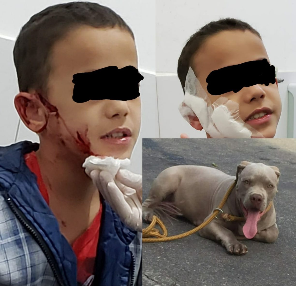 Brumado: Xulim ataca Curumim de 9 anos no Santa Tereza | O efuxico explica onde o dono do cachorro entra nessa história.