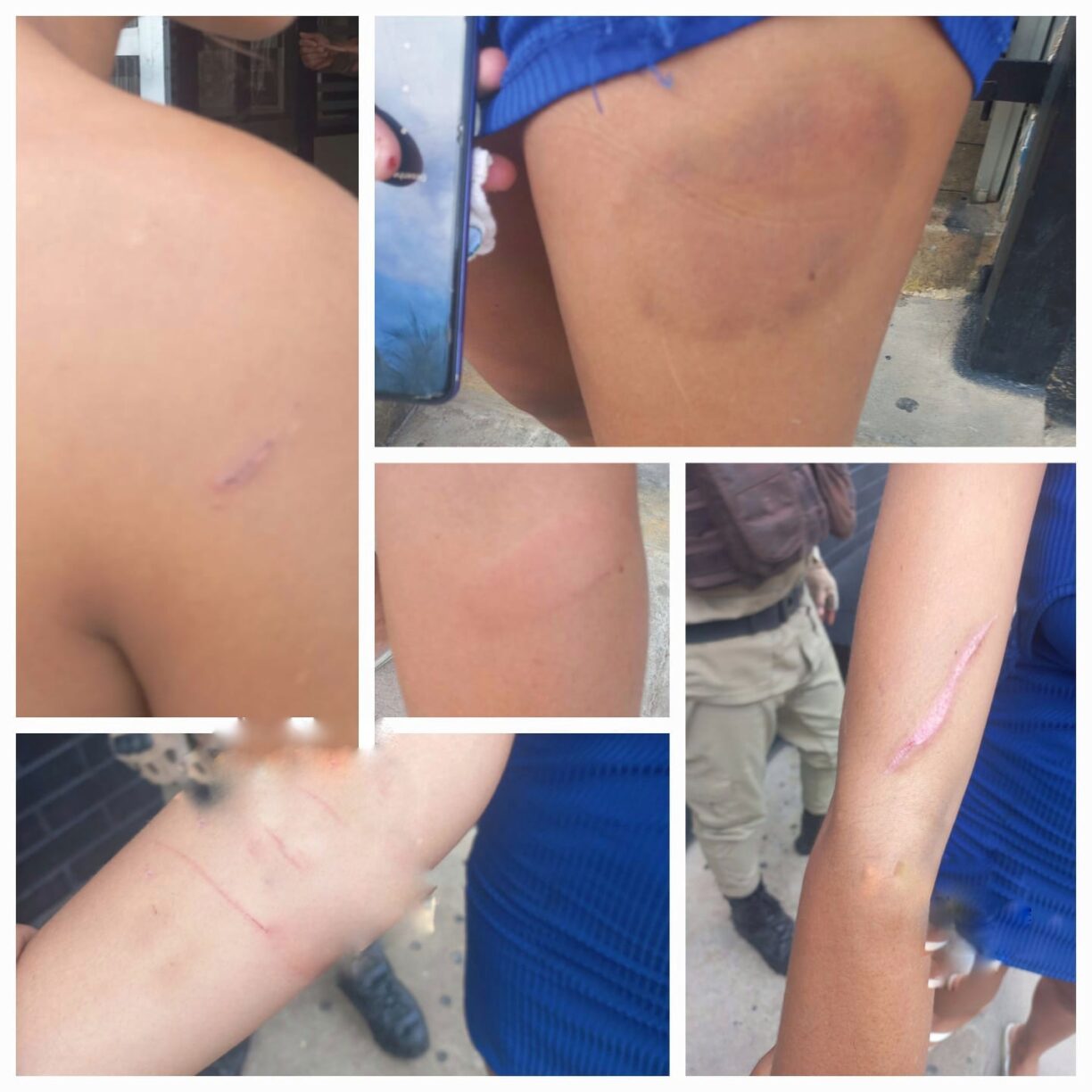 Brumado: PM prende lazarento que agrediu mulher no Irmã Dulce.